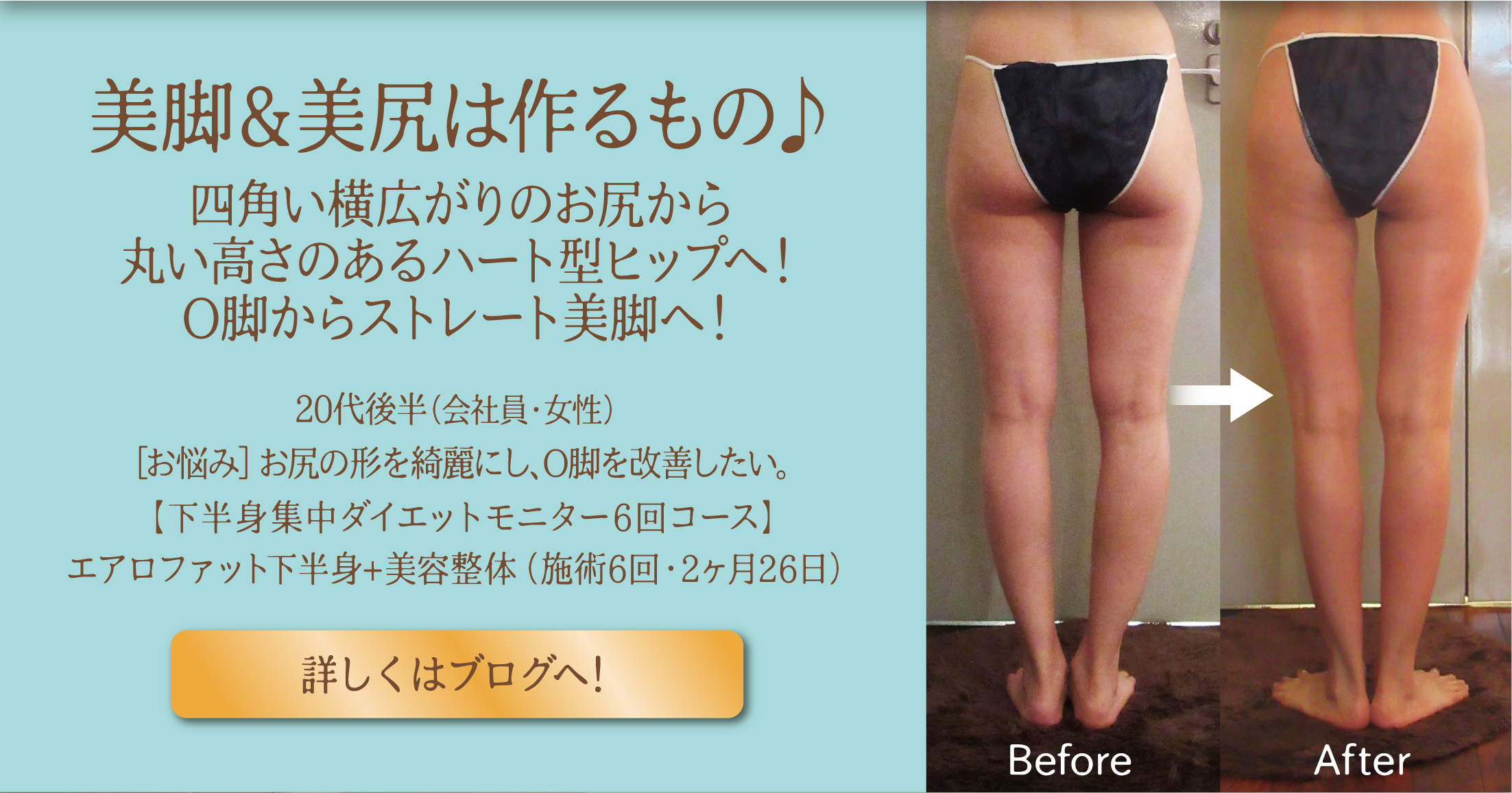 キャンペーン