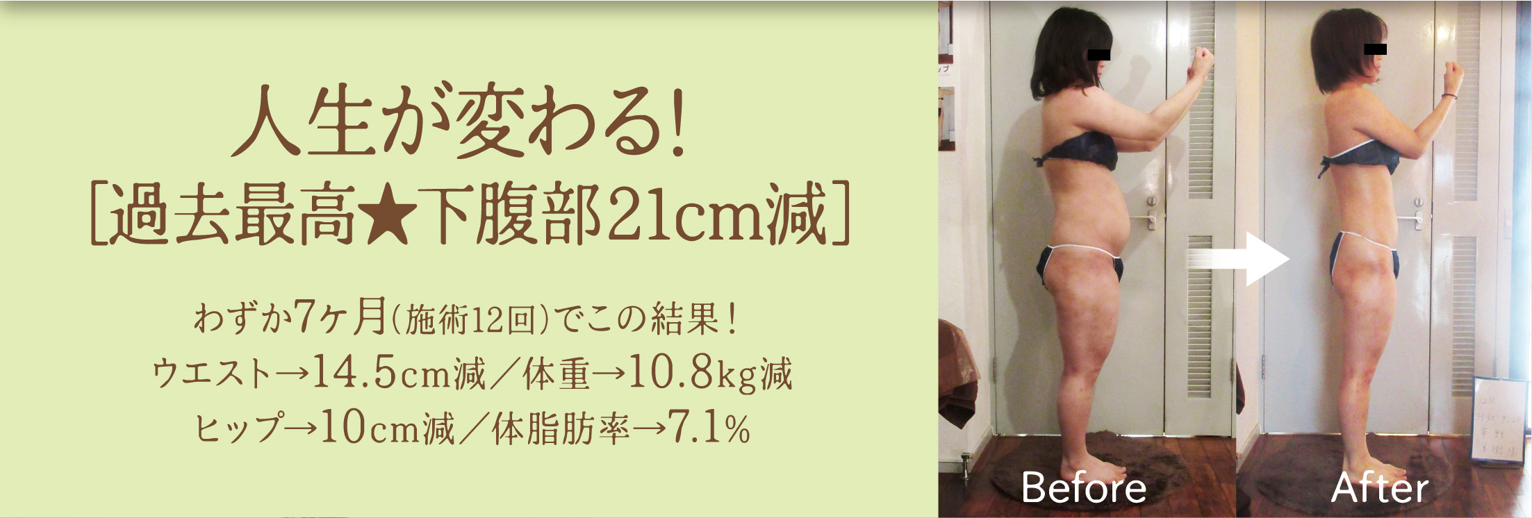 キャンペーン